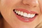 Clareamento dental a laser - um grande aliado da estética
